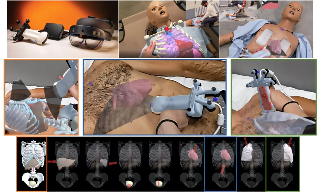 Yeni anatomik yönlendirme sistemi, traumalı hastalarda FAST ultrason görüntülerini öğrenen yeni kullanıcılar için destek sağlıyor
