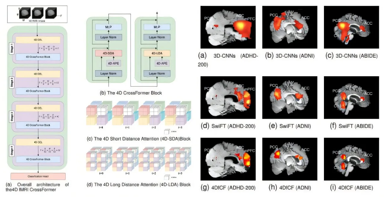 Yeni 4D fMRI CrossFormer, AI destekli beyin bozukluk tarama sürecini daha şeffaf ve hesaplamalı olarak verimli hale getiriyor