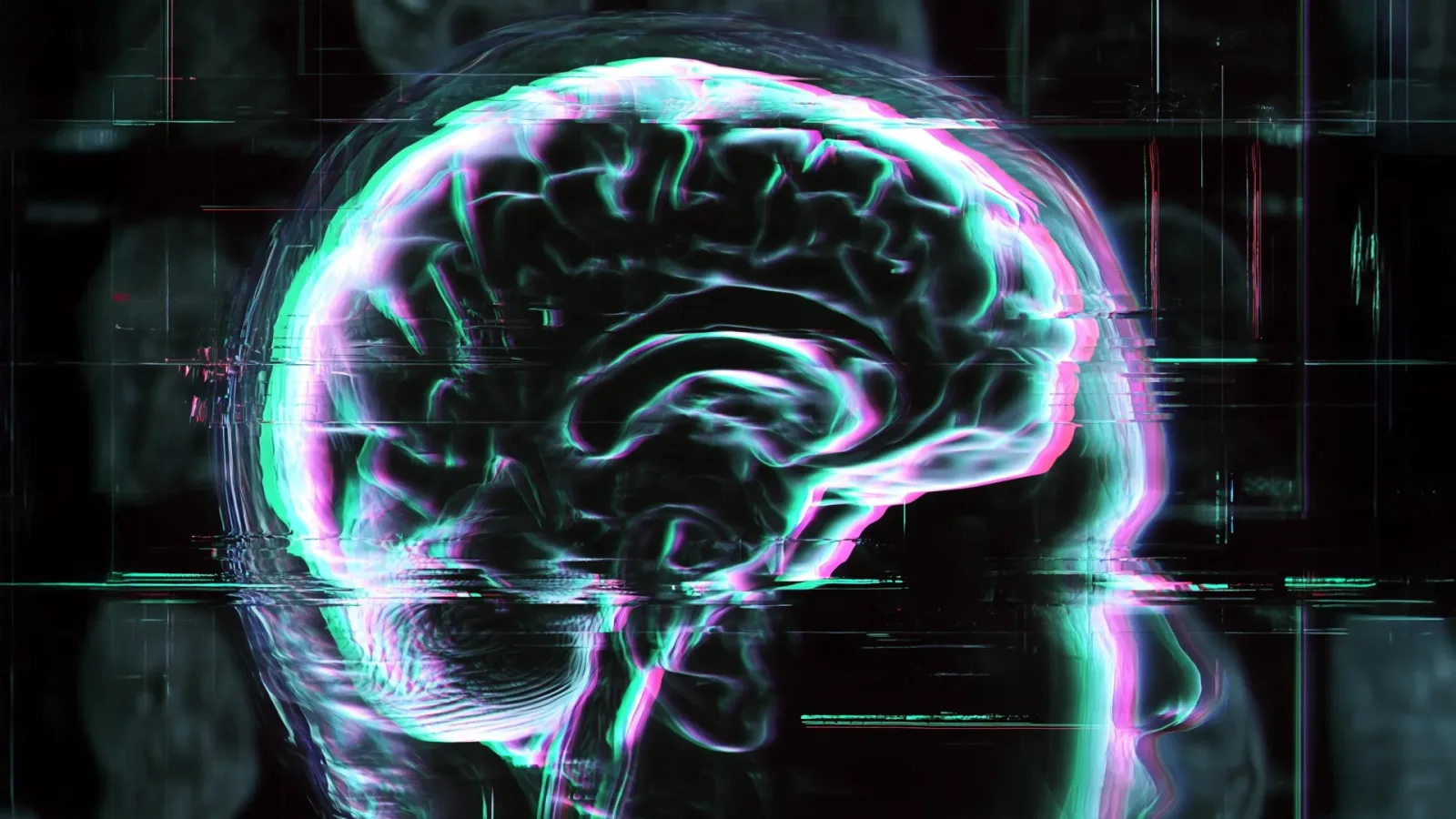 Alzheimer ve hafif kognitif bozukluk, beyin yaşlanmasını en çok hızlatan hastalıklar