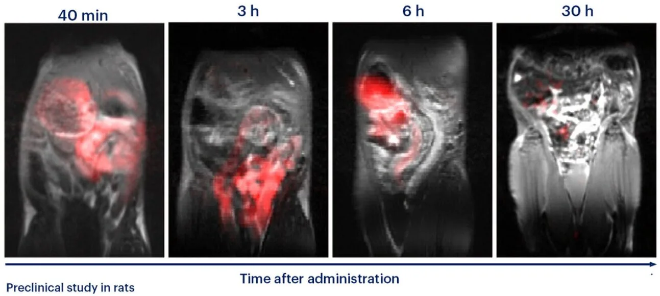 Yeni polimer, gastrointestinal transiti izlemek için iyonizing radyasyon kullanmadan MRI ile izlenebilir