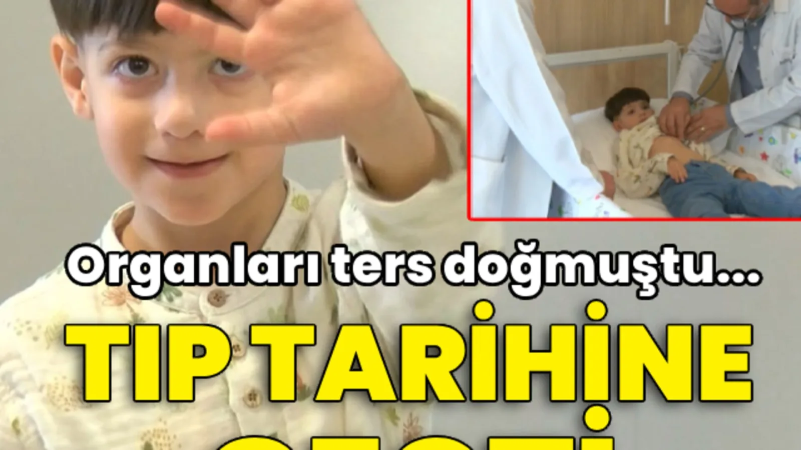 Ankara'da organları ters tarafta doğan Suriye uyruklu 5 yaşındaki çocuk, ameliyatla sağlığına kavuştu