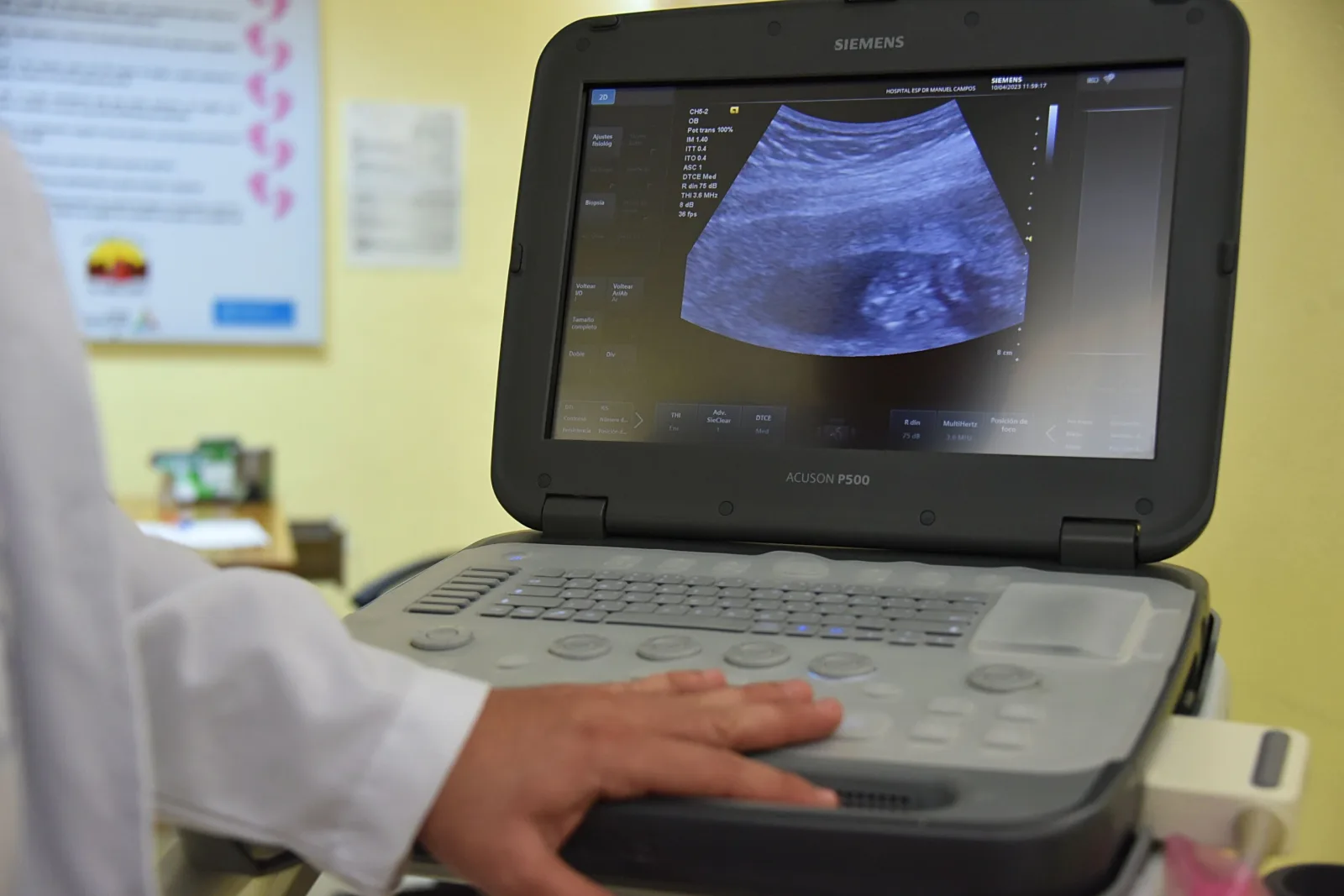 Diagnostik ultrason güvenliği için uluslararası kılavuzlar yayınlandı