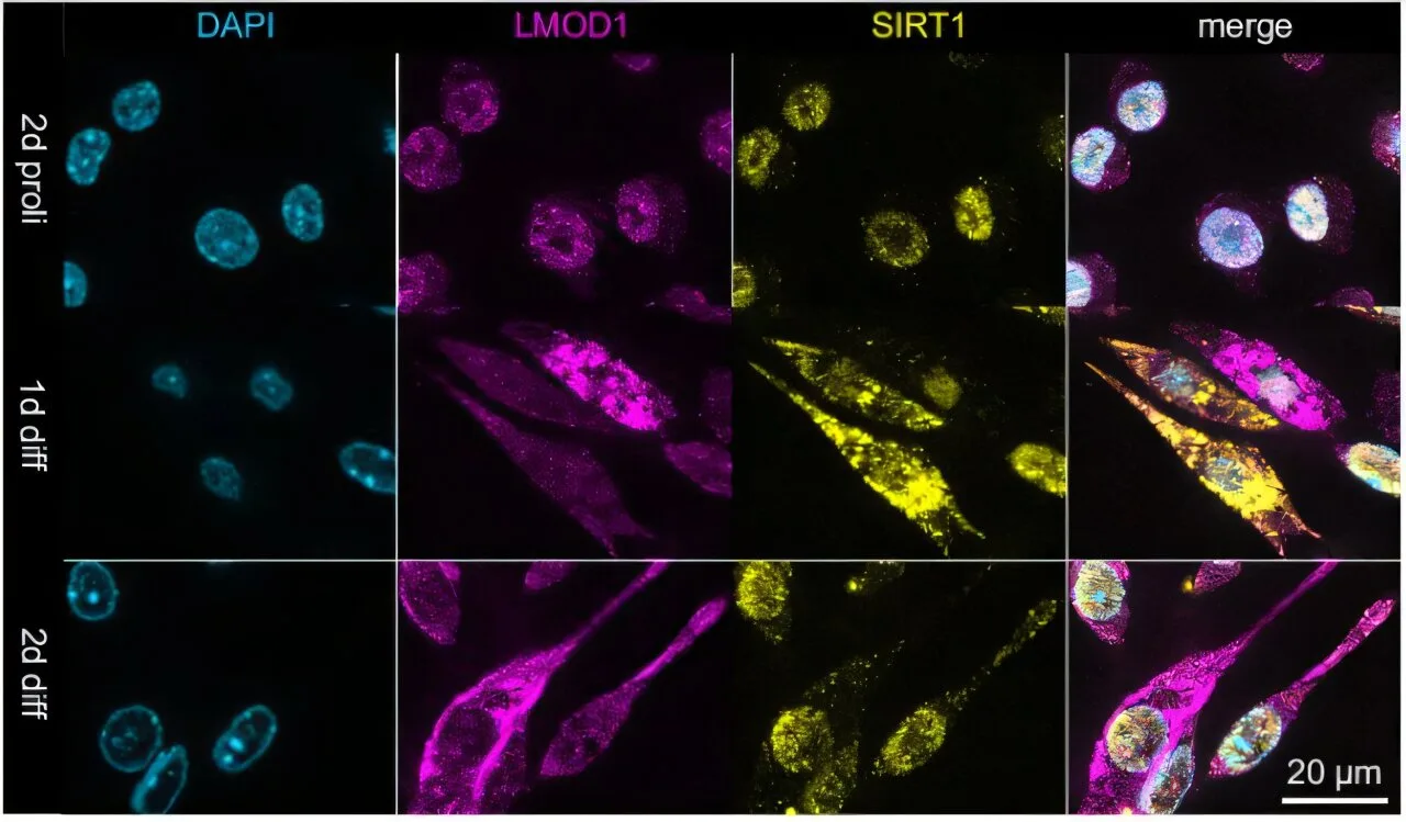 LMOD1 proteini kas yenilenmesinde yeni ipuçları sunuyor