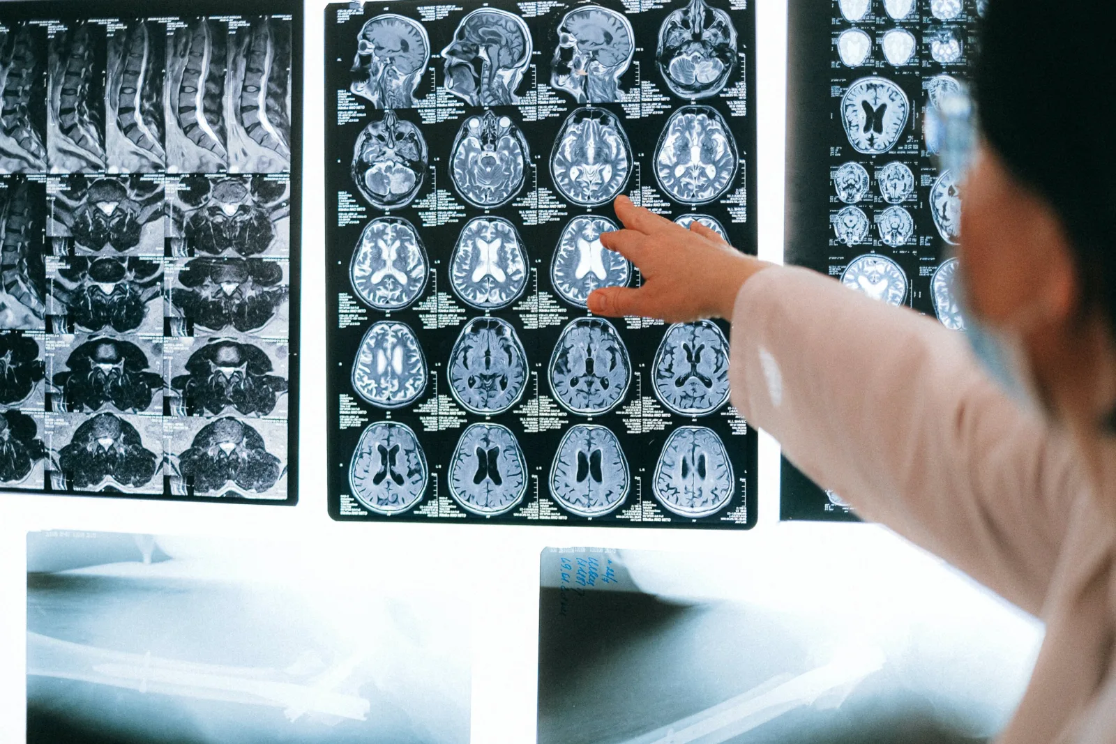 10.000 ergenin MRI verileriyle gençlik beyin gelişimi haritası oluşturuldu
