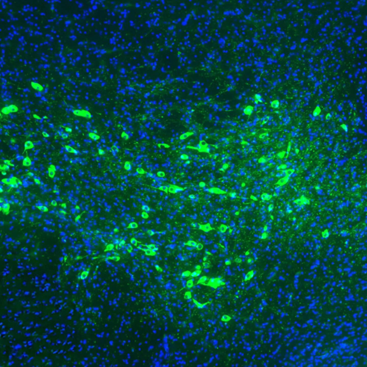 Misfolded alfa-sinüklin proteinlerini yönetmek Parkinson hastalığını önleyebilir
