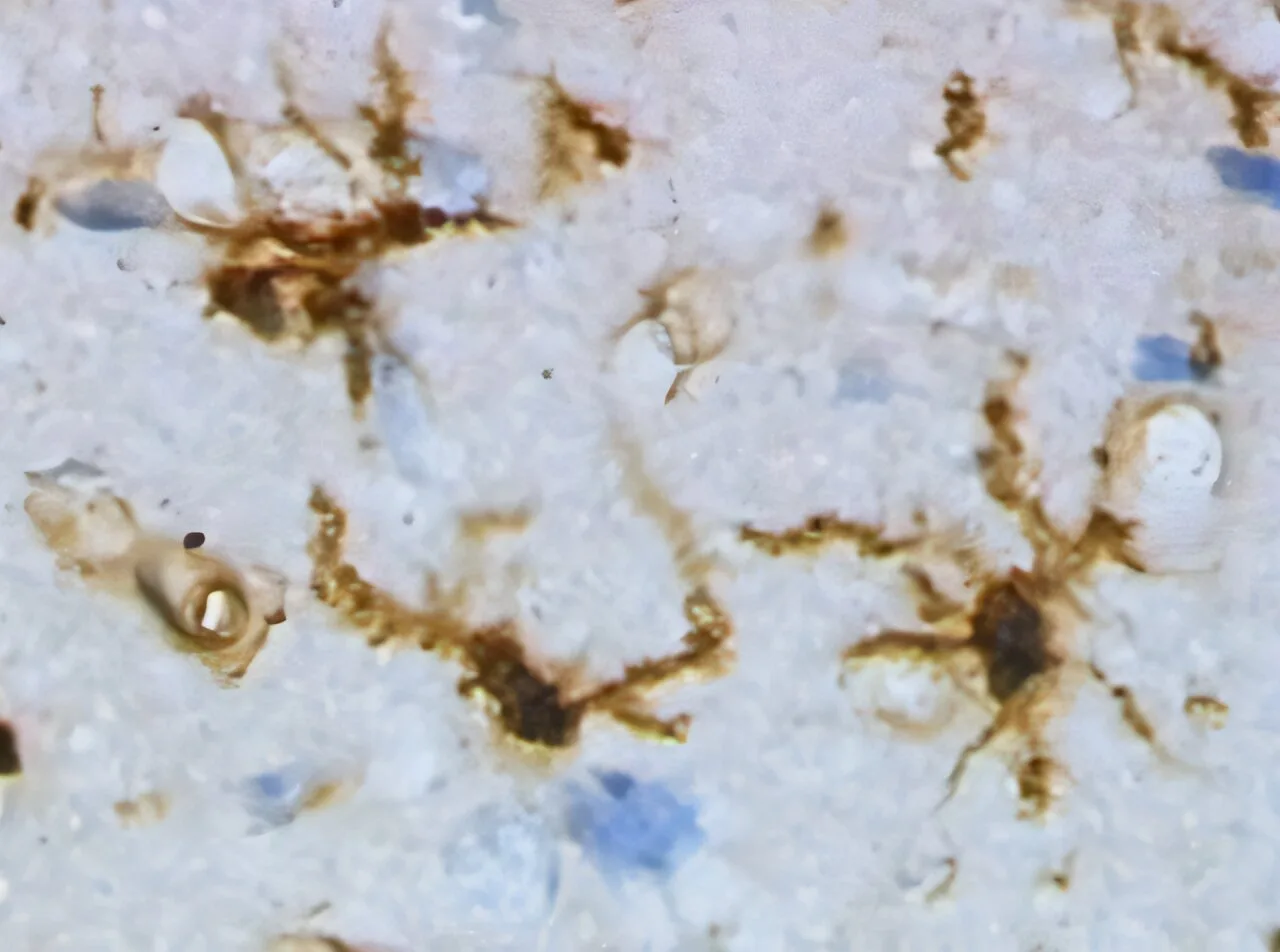 Beyin immün hücreleri, Parkinson hastalığında nöronları zararlı maddeleri 'öterek' koruyor
