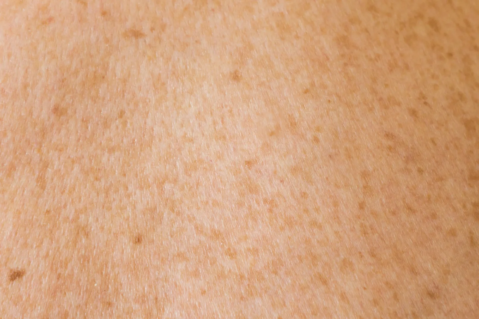 Özerk Yapay Zeka, İki İngiltere Hastanesinde 8.500 Fazla Dermatoloji Randevusu Oluşturabilir